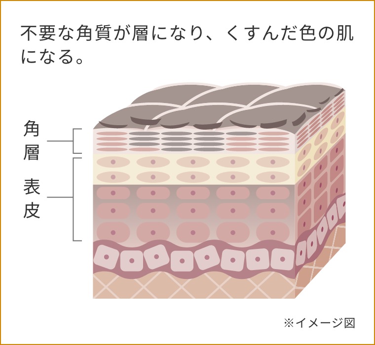 ターンオーバーが乱れた肌